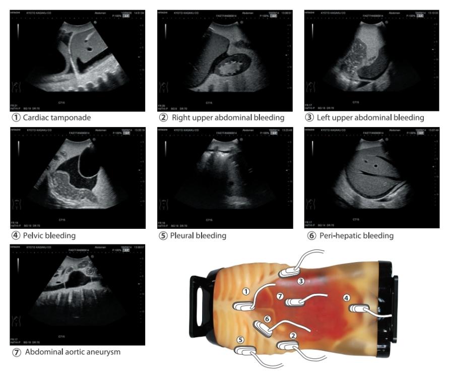 Fast Acute Abdomen Phantom - High-Quality FAST ER FAN Ultrasound Training Model for Trauma Sonography | Ideal for Medical Simulation, Emergency Room Training & Diagnostic Practice