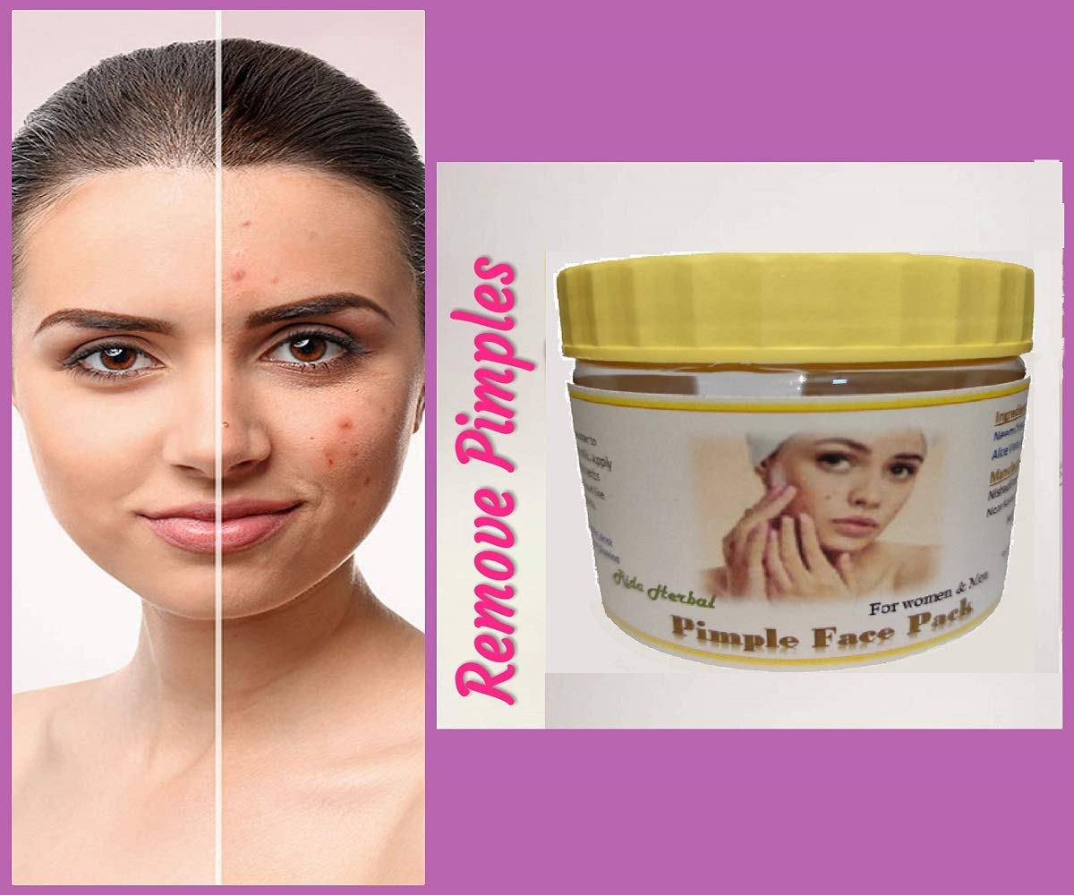 Rida Herbal Special Pimple & Acne Removal Face Mask with 19 Natural Ingredients - Neem & Lal Chandan for Women & Men | Clear Skin Treatment for Acne-Prone Face | Perfect for Daily Skincare Routine & Spa Days
