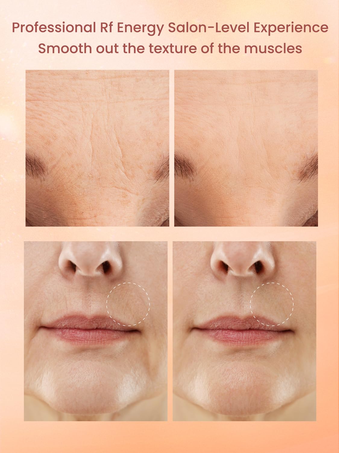 RF Skin Tightening Device for Face - Anti-Aging Wrinkle Removal & Lifting Machine, Wireless Home Beauty Device with 3 Levels for At-Home Skin Renewal | Perfect for Daily Skincare Routine, Salon-Quality Facial Treatment & Anti-Aging Care