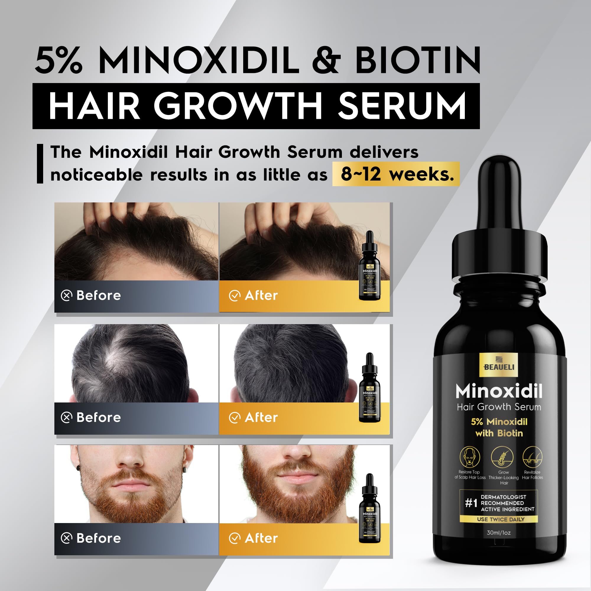 5% Minoxidil Hair Growth Treatment for Men & Women - Extra Strength Hair Loss Serum for Faster, Stronger, Thicker Hair - 3 Pack (1oz Bottles) - Perfect for Daily Use & Revitalizing Thinning Hair at Home