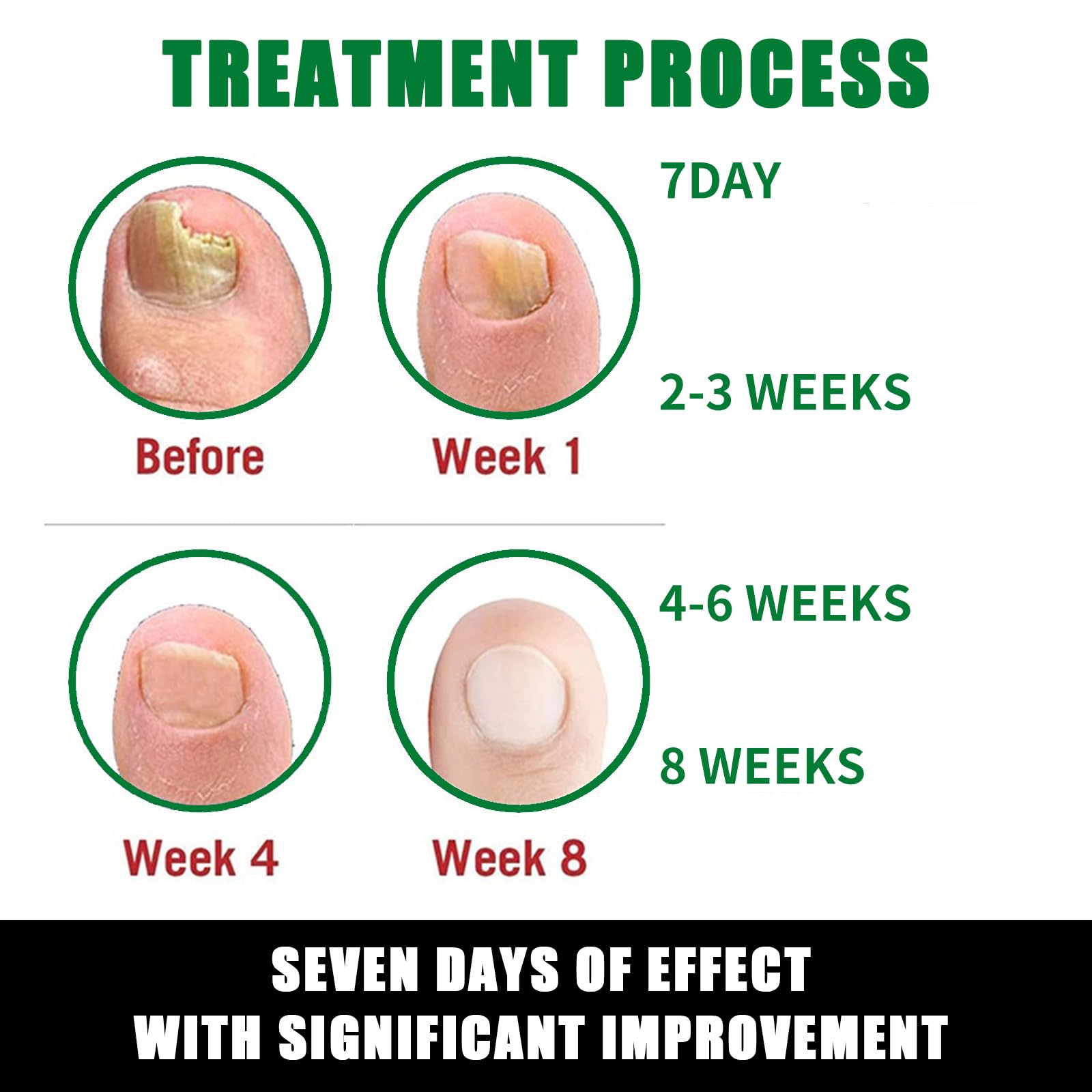 7Days Ginger Nail Growth Treatment Oil - Multi-Purpose Nail Repair & Strengthener Serum with Nutrients | For Brittle, Weak Nails & Cuticle Care | Perfect for At-Home Manicures & Nail Salon Use