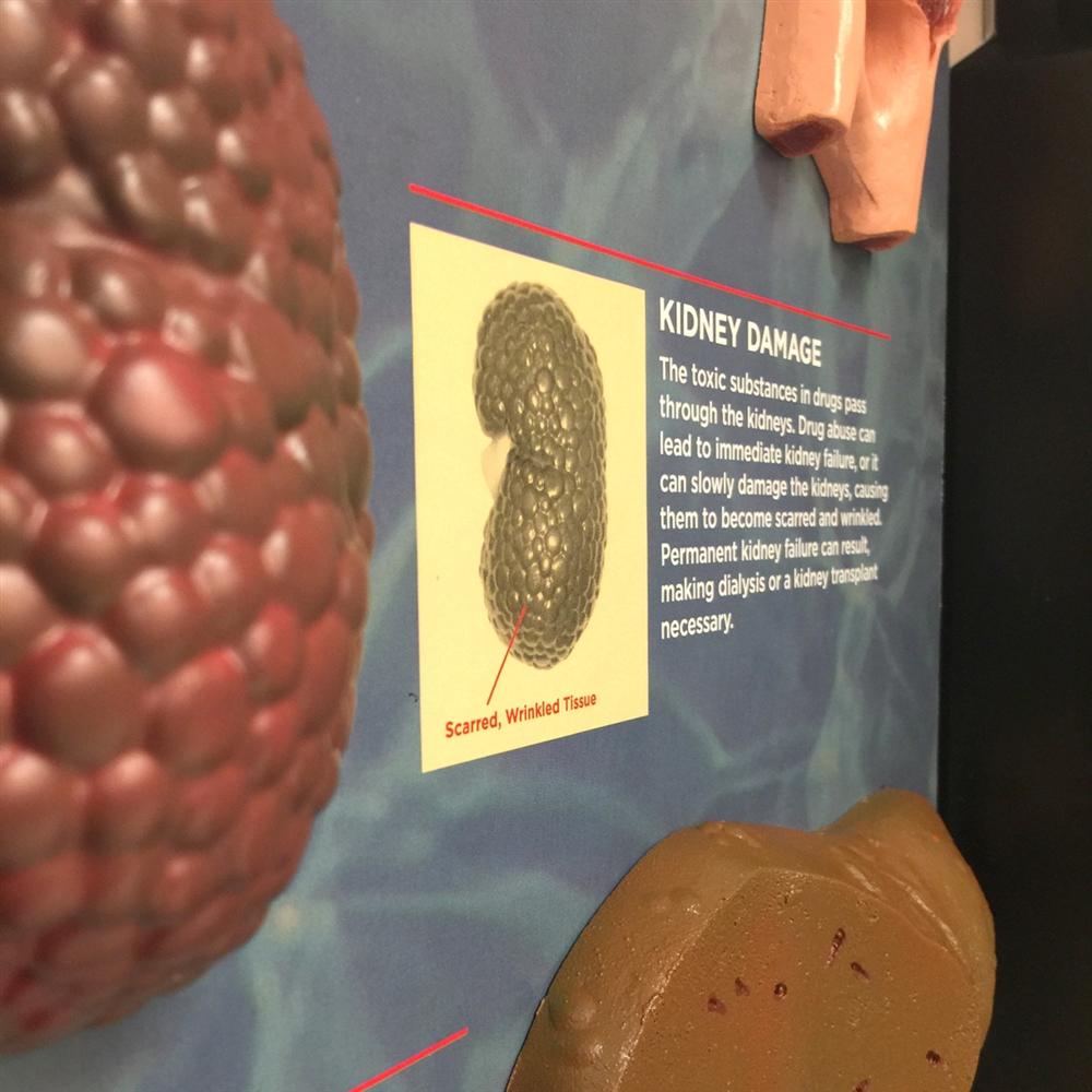 3D Educational Display on Drug Abuse Consequences - Visual Learning Tool for Schools & Awareness Programs
