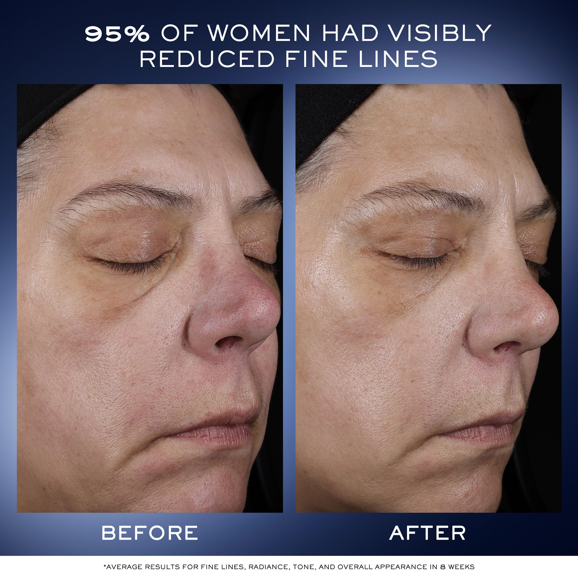 Lancôme Génifique Ultimate Dual Recovery Anti-Aging Face Serum with Beta Glucan & Hyaluronic Acid - Visibly Reduces Fine Lines, Improves Skin Texture & Evens Tone for Youthful Glow - Perfect for Nighttime Skincare Routine & Daily Moisturizing
