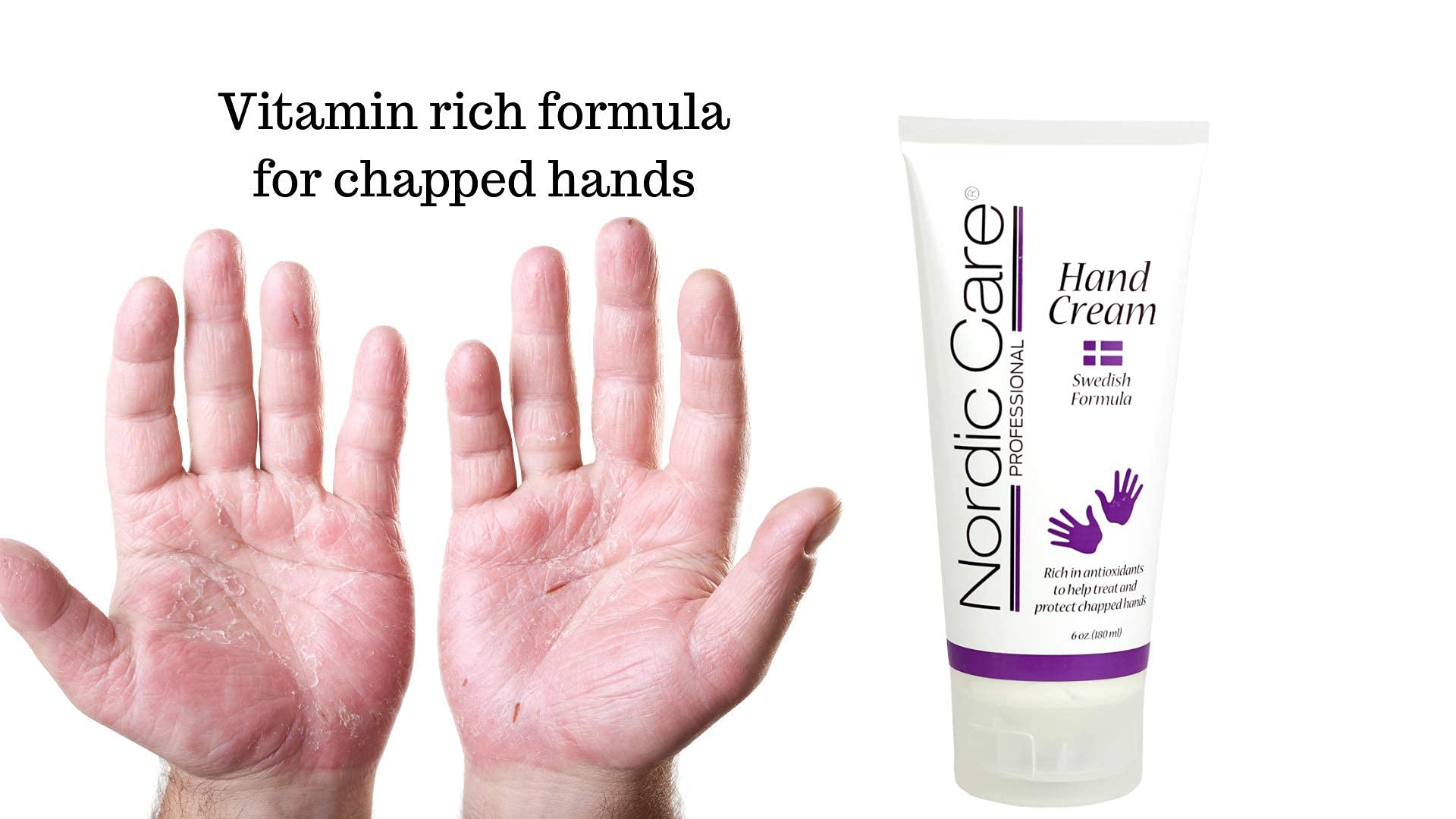 Nordic Care Foot Care Cream & Hand Cream Set (2 Pack) – Intense Hydration for Severely Dry Feet & Cracked Heels | Urea & Glycerin Formula Soothes Itchy Dry Skin – Perfect for Home Spa, Travel & Daily Moisturizing