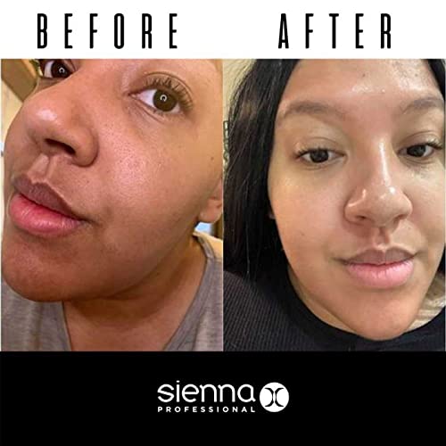 Sienna X The Cleansing Lotion 200ml - Coconut Oil Makeup Remover & Moisturizing Face Wash for Oily & Acne-Prone Skin | Gentle Daily Cleanser for Men & Women | Restores Hydration & Purifies Skin | Ideal for Morning & Night Skincare Routine