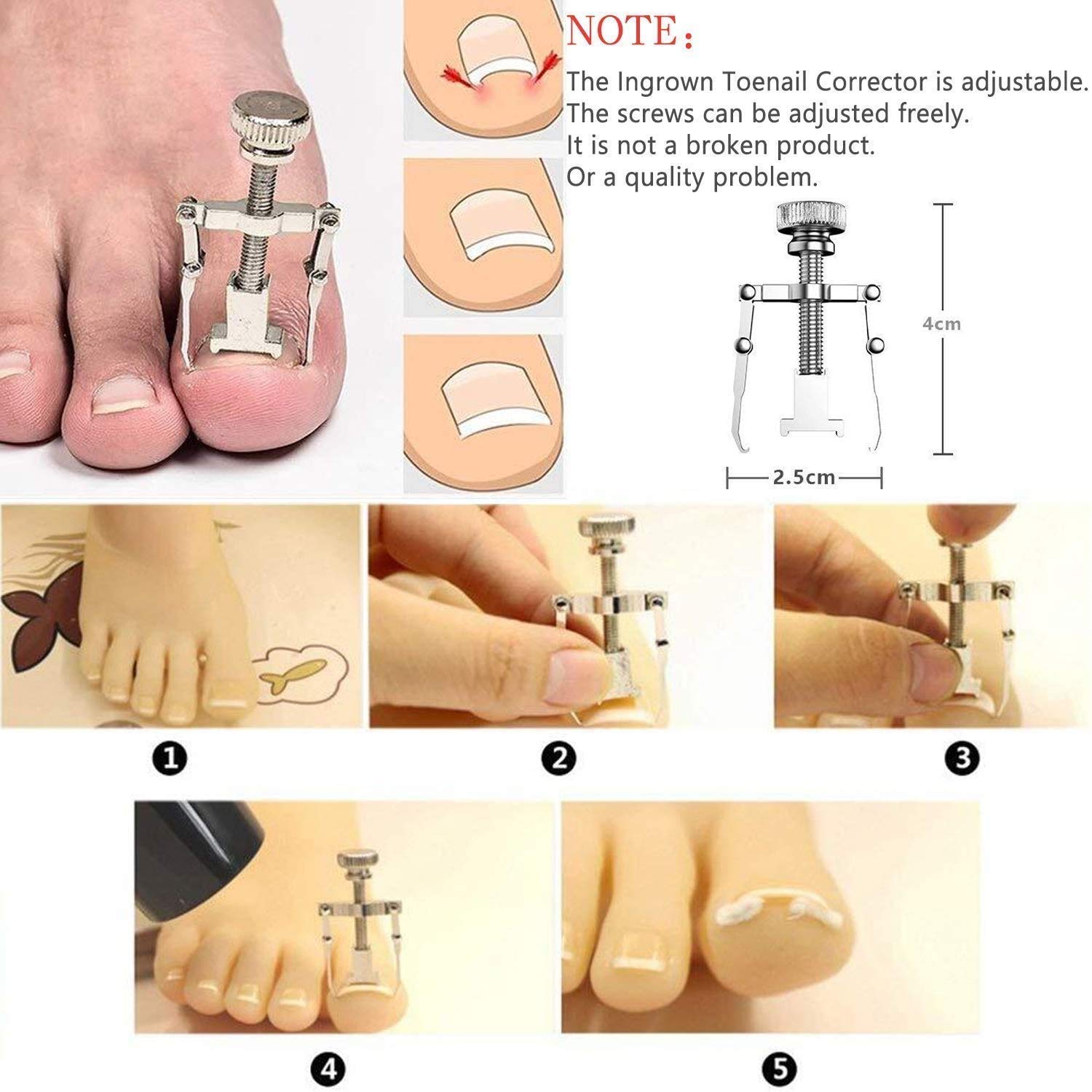 Professional 9-Piece Ingrown Toenail Clipper Kit - Stainless Steel Toenail Treatment Tools for Ingrown & Thick Nails - Perfect for Home Pedicure, Nail Care & Podiatry Use