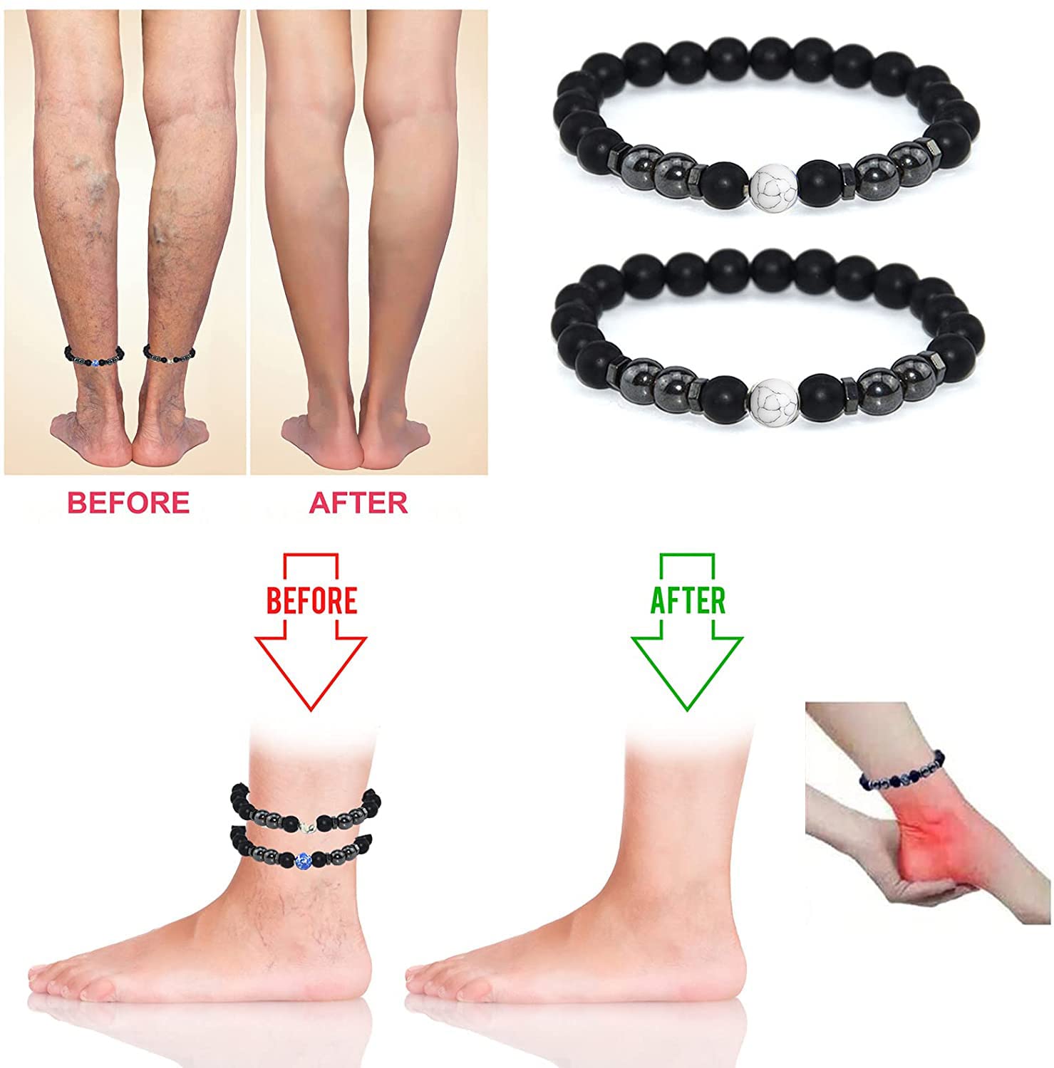 4PCS Black Obsidian Anklet & Bracelet Set - Anti-Swelling, Lymphatic Drainage, Anti-Anxiety Healing Stone Jewelry for Women & Men - Perfect for Yoga, Meditation & Stress Relief