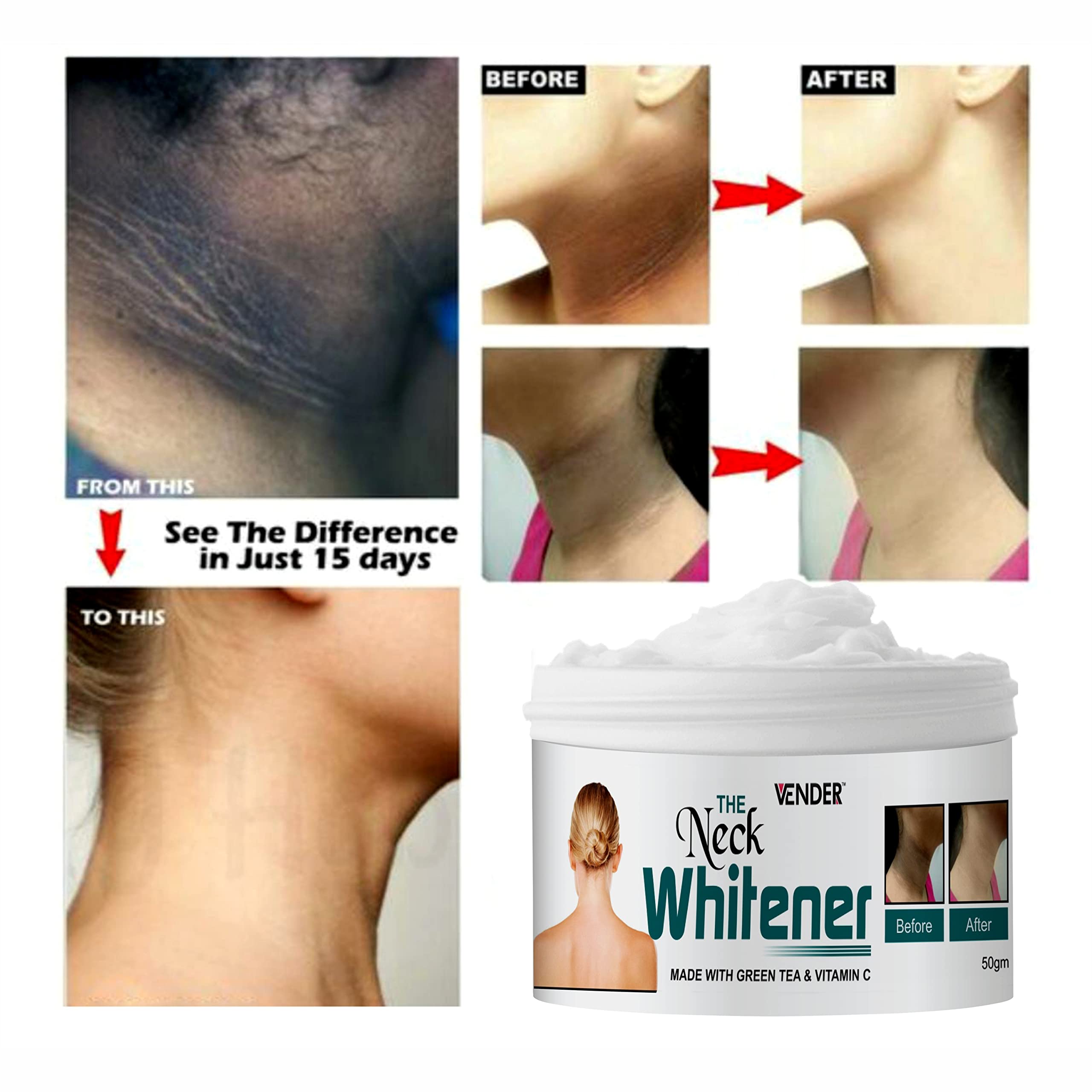 Best Green Tea & Vitamin C Brightening Cream for Dark Neck, Knees & Elbows - 50g | Hydrating & Lightening Skin Care for Hyperpigmentation | Perfect for Daily Use & Night Routine