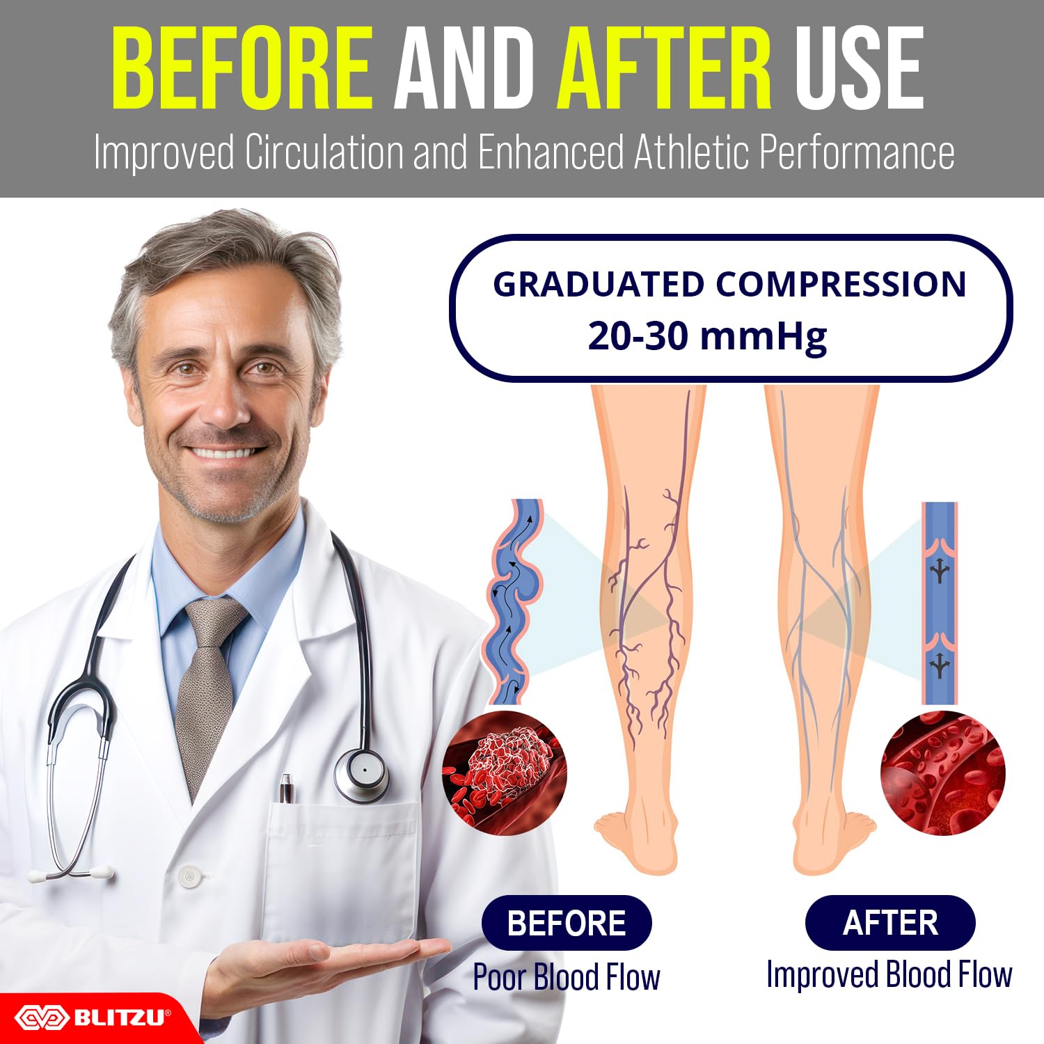 BLITZU Compression Socks for Women & Men - Medical Grade Support Socks for Improved Circulation & Swelling Relief - Best for Running, Travel & Recovery (20-30 mmHg) - Perfect for Nurses, Athletes & Long Flights