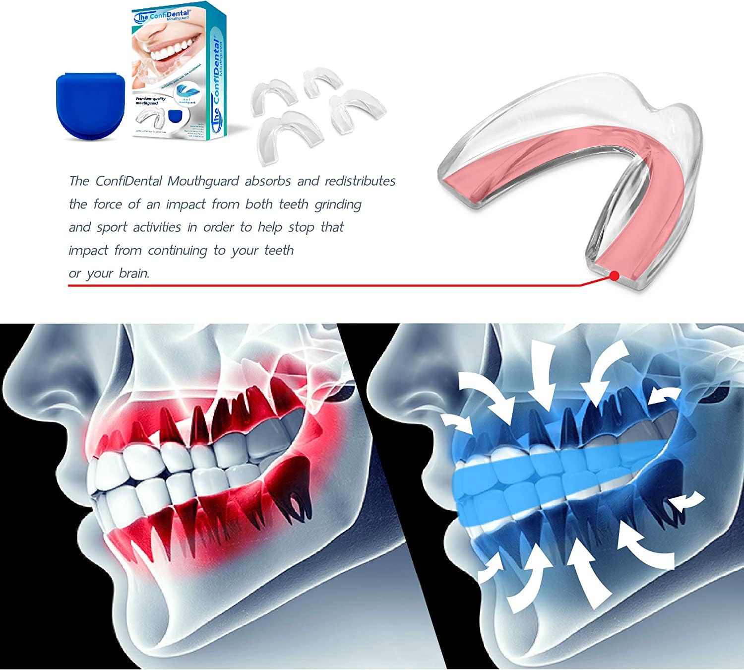 Custom Moldable Mouth Guard for Teeth Grinding & Clenching (Bruxism) - Pack of 8 (4 Regular + 4 Small) - Night Guard for Sleep & Sports - Whitening Tray Compatible - Perfect for Athletes, Teeth Grinders & Teeth Whitening Use