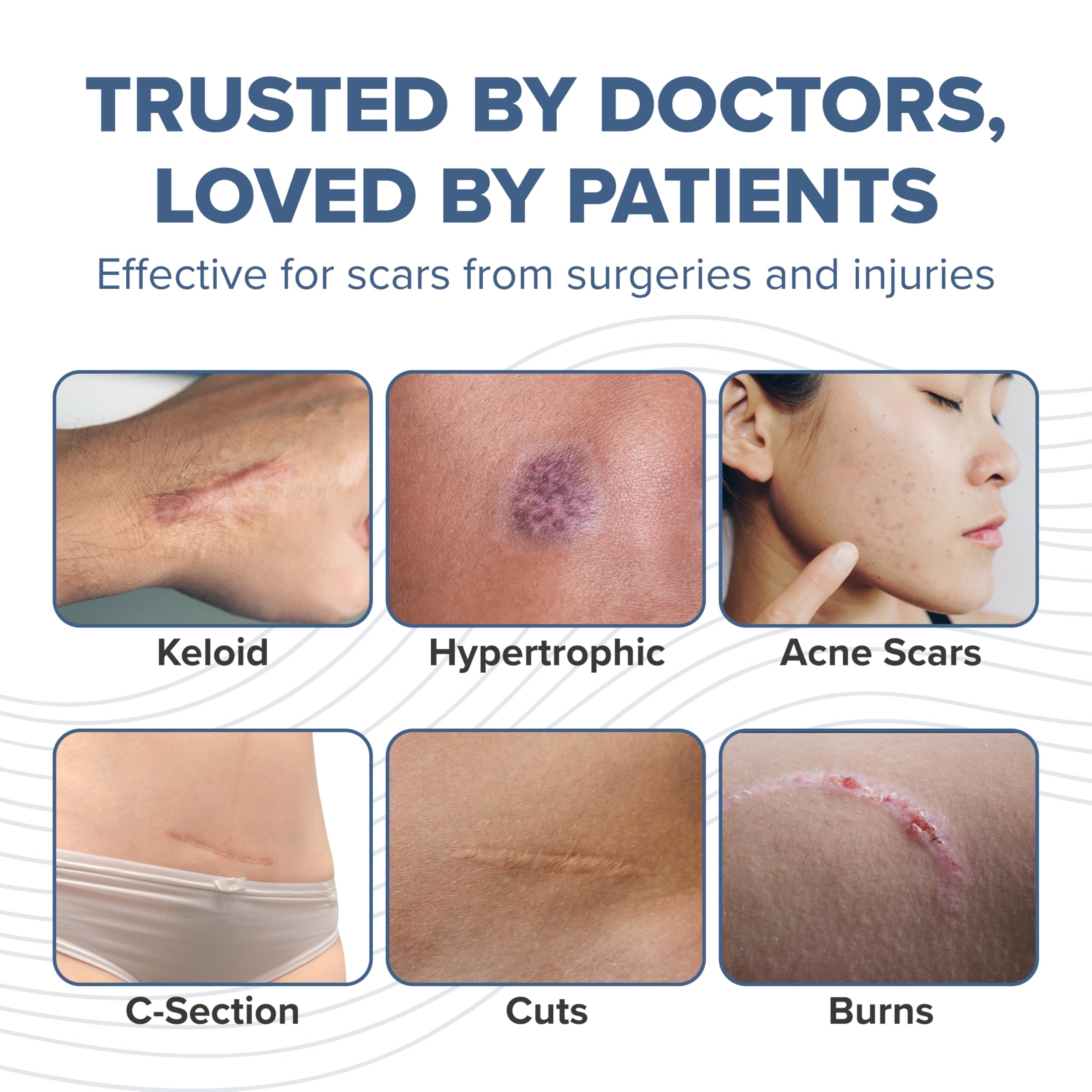 ProSIL Silicone Scar Stick - Effective Scar Treatment Gel for Surgical Scars, Acne, Burns & C-Sections | Safe for Kids, Men & Women | Medical-Grade Silicone Scar Therapy (17g) | Perfect for Post-Surgery Recovery & Daily Skin Care