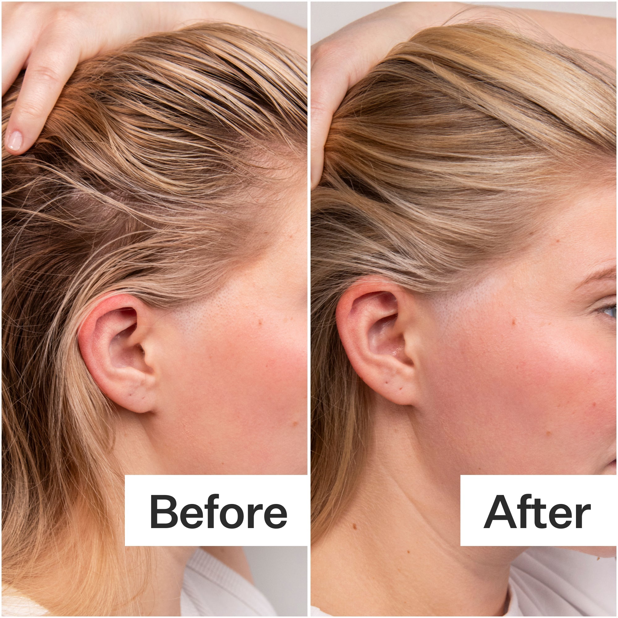 Act+Acre 4% Niacinamide Scalp Serum for Oily Hair - Oil Control & Scalp Balancing Treatment for Healthy Hair Growth - Perfect for Daily Use & Post-Workout Care