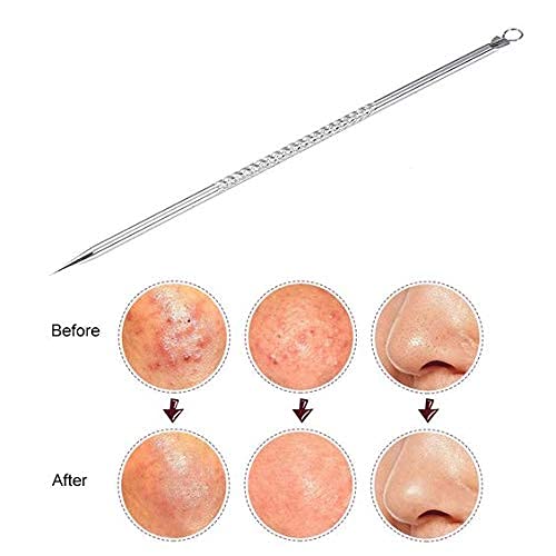Professional Acne Extractor Kit - Blackhead Tweezers & Pimple Popper Tool for Blackheads, Whiteheads & Ingrown Hairs | Comedone Extractor Set for Facial Blemishes & Skin Impurities | Perfect for Home Spa & Skincare Routine
