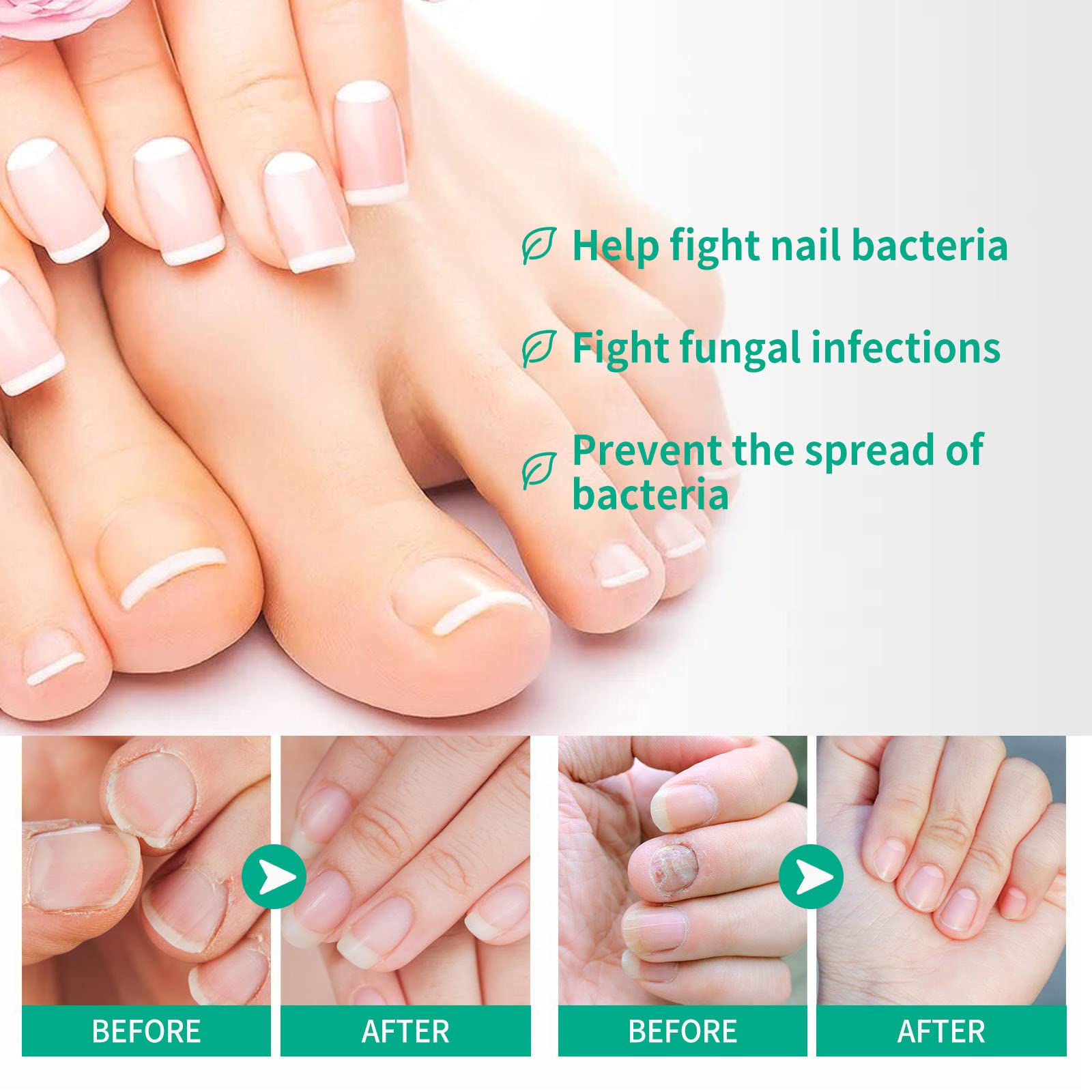 Kerassentials Toenail Fungus Treatment Oil - Natural Nail Repair Solution for Fungal Infections (3 Pack) - Perfect for Athletes, Swimmers & Daily Foot Care
