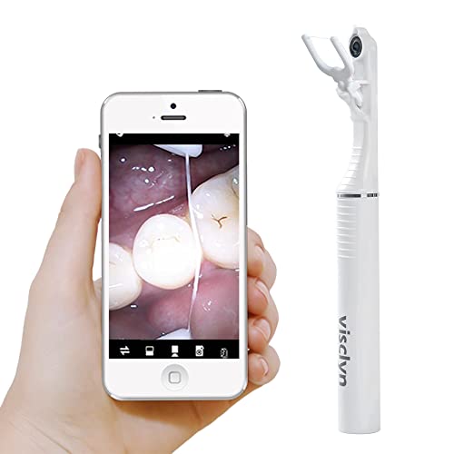 Smart Dental Floss with HD Camera & App - Includes 1 Floss Holder, 30 Disposable Picks & 20 Cleaning Pads (Pearl White) | Perfect for Home Oral Care & Teeth Whitening Routine