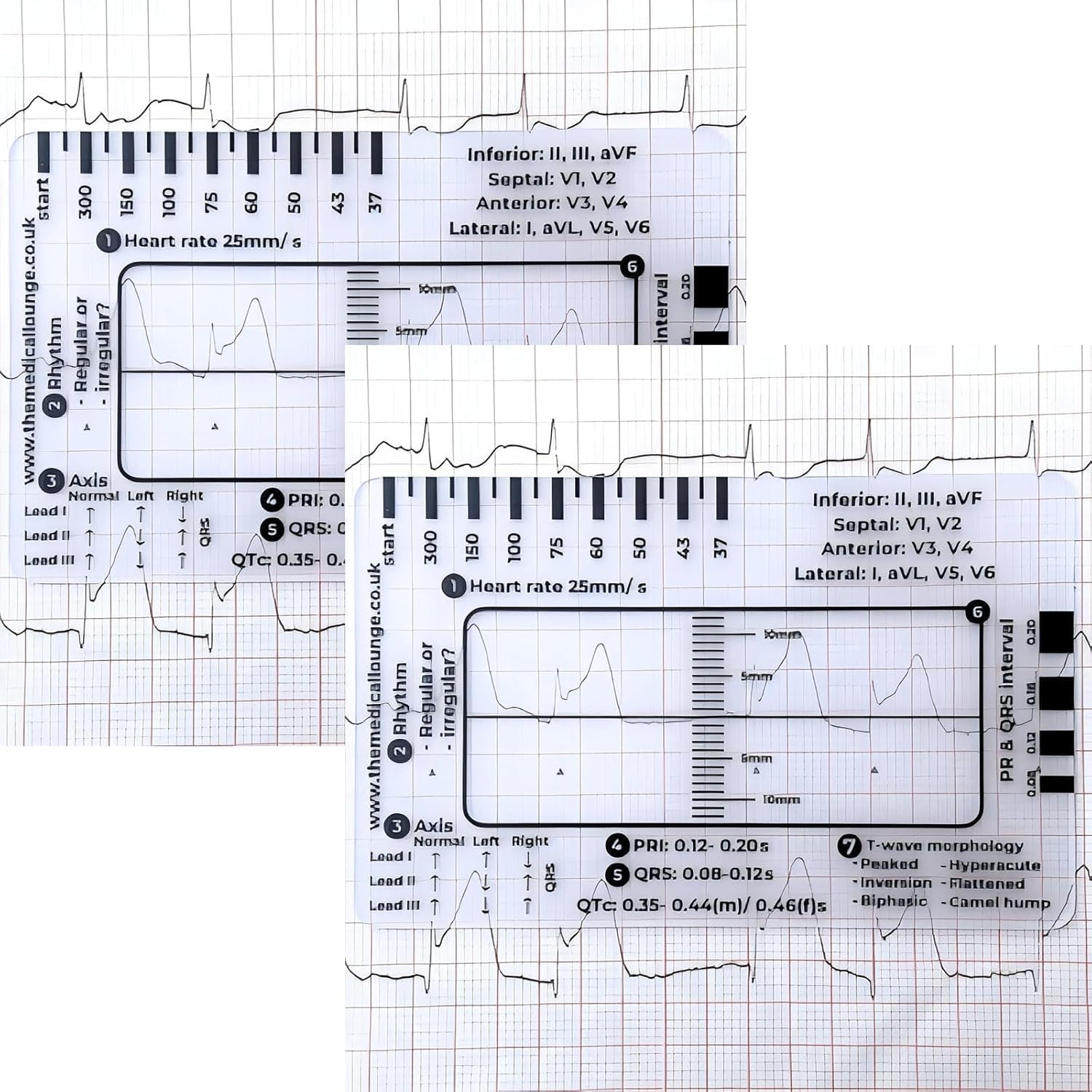 7-Step ECG Ruler for EKG Interpretation - Transparent Caliper Measuring Tool with Portable Assessment Card (2PCS) - Perfect for Medical Students, Nurses & Doctors for Heart Rate Monitoring & ECG Analysis