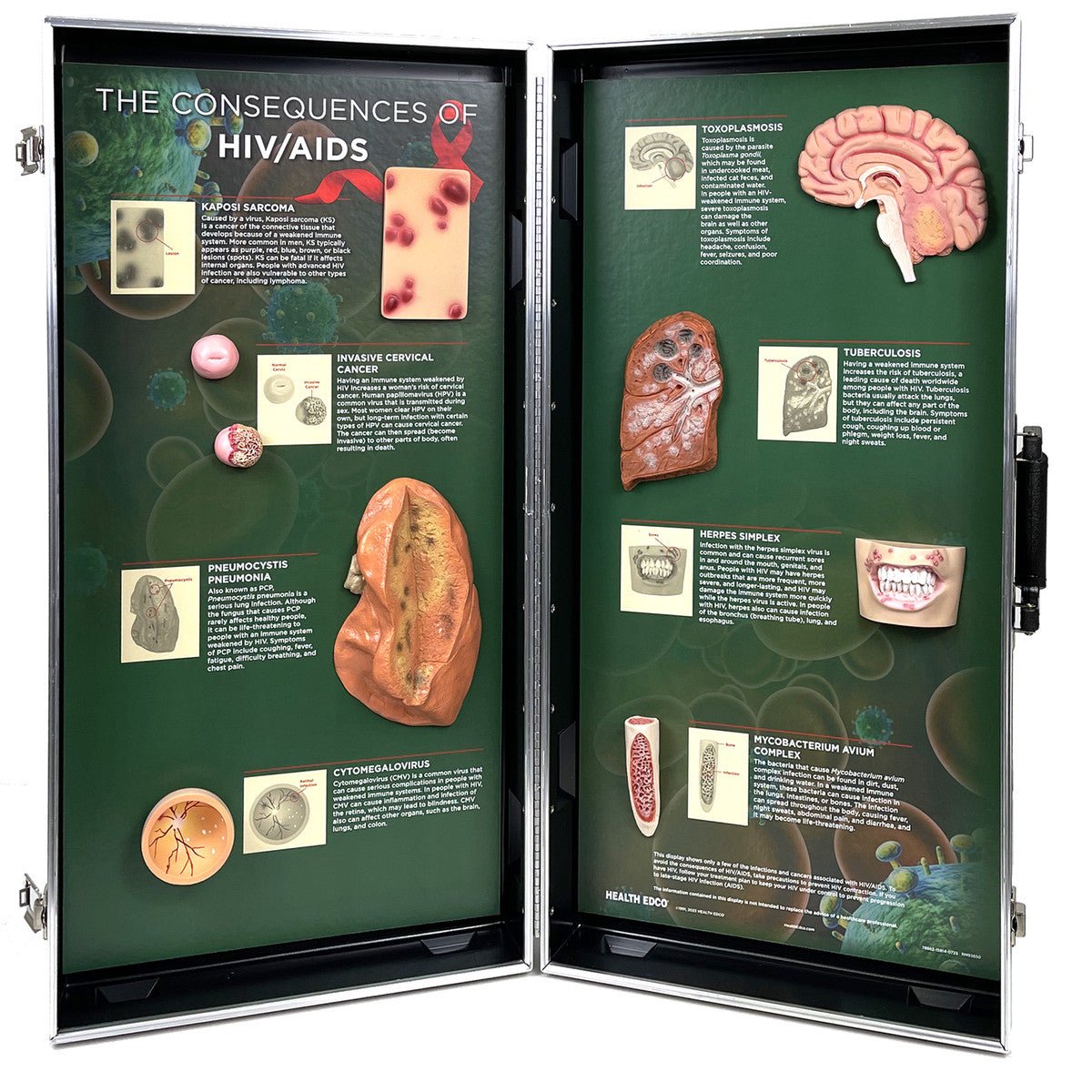 HIV/AIDS Educational 3D Display Model - Anatomy & Disease Awareness Tool for Classrooms, Medical Training & Health Education
