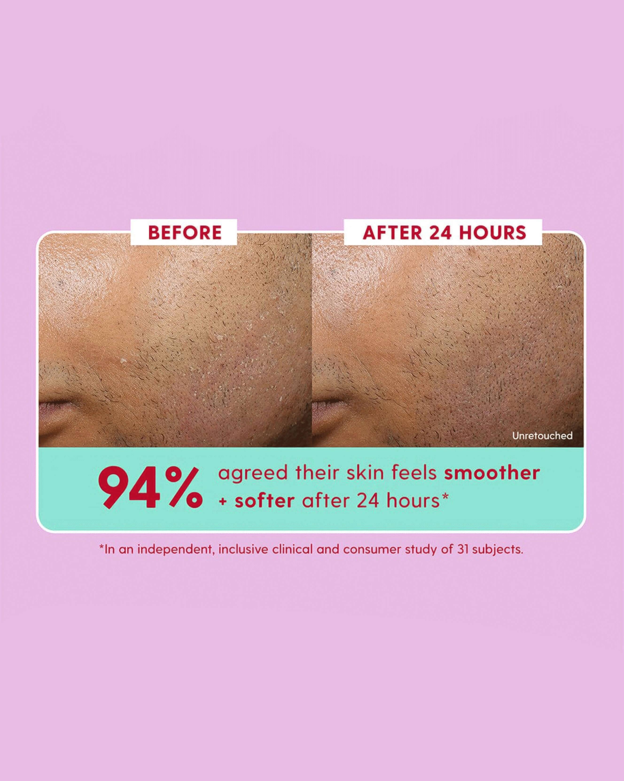 10% Glycolic Acid Face Serum for Exfoliation & Skin Renewal - Brightening Treatment for Acne, Wrinkles & Dark Spots - Daily Use for Glowing Skin