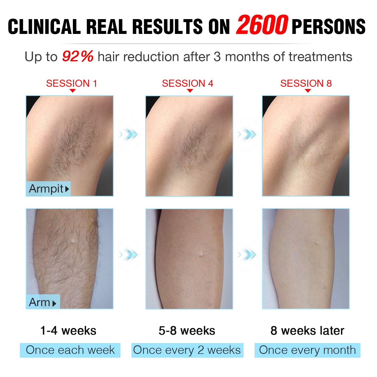 IMENE Painless IPL Laser Hair Removal Device for Women & Men - Permanent Hair Remover for Bikini, Legs, Arms, Armpits - Most Effective IPL Technology (Intense Pulsed Light) - At-Home Hair Removal Solution for Smooth Skin