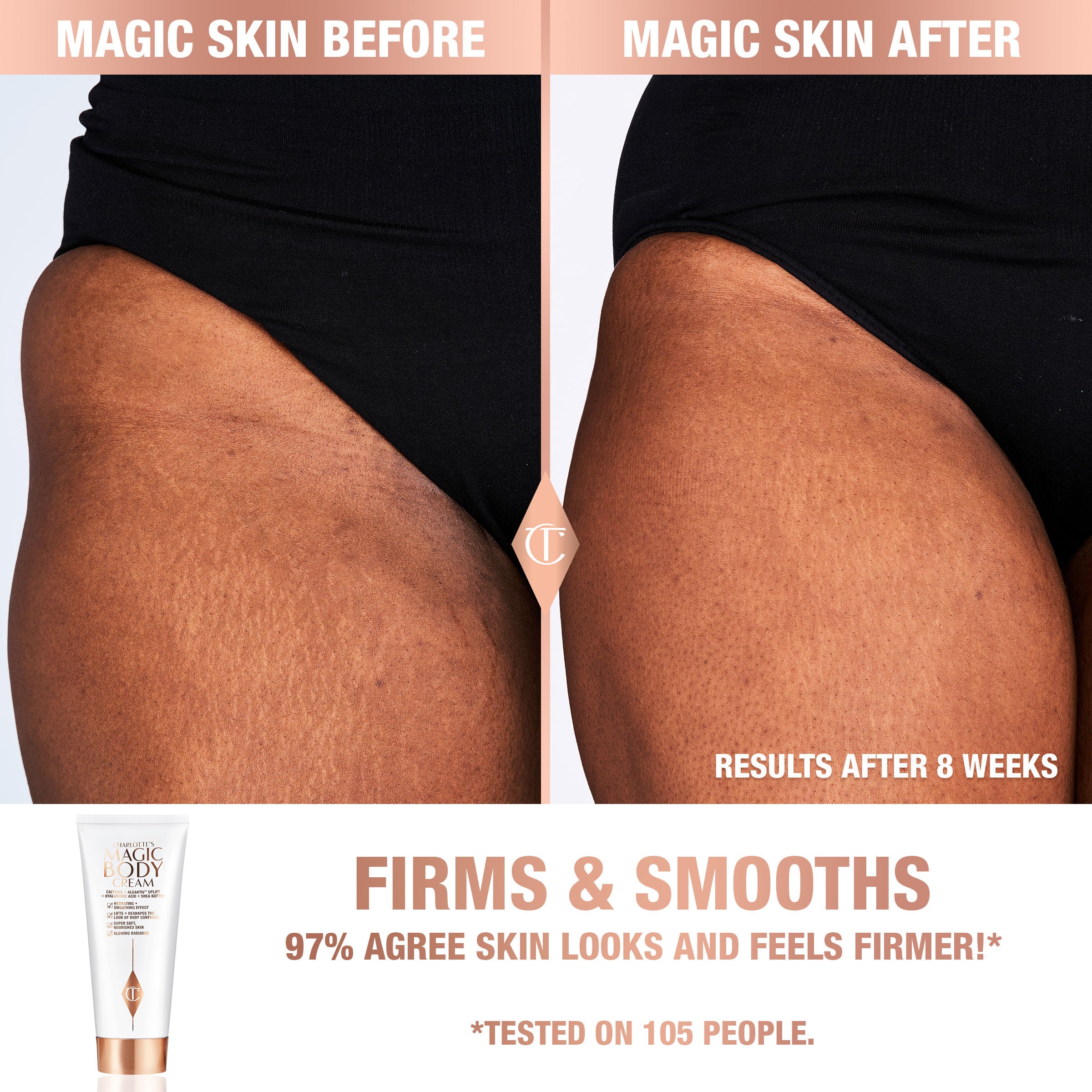 Charlotte's Magic Body Cream - Hydrating & Firming Moisturizer for Dry Skin | Anti-Aging & Stretch Mark Reduction | Perfect for Daily Skincare & Post-Pregnancy Care