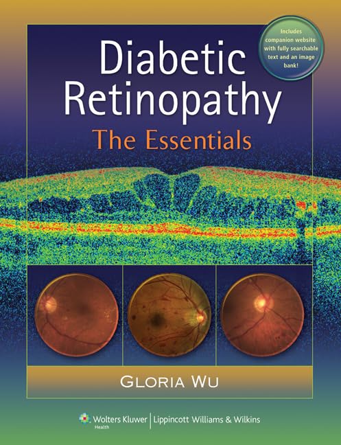 Diabetic Retinopathy: Symptoms, Causes & Treatment Options | Eye Care for Diabetes | Home & Clinical Use
