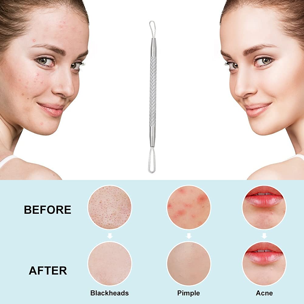 KIRA 2-in-1 Stainless Steel Pimple & Blackhead Remover Tool - Comedone Extractor for Acne Prone Skin (Men & Women) - Silver (Pack of 1) | Perfect for Home Skincare Routine & Travel Beauty Kit