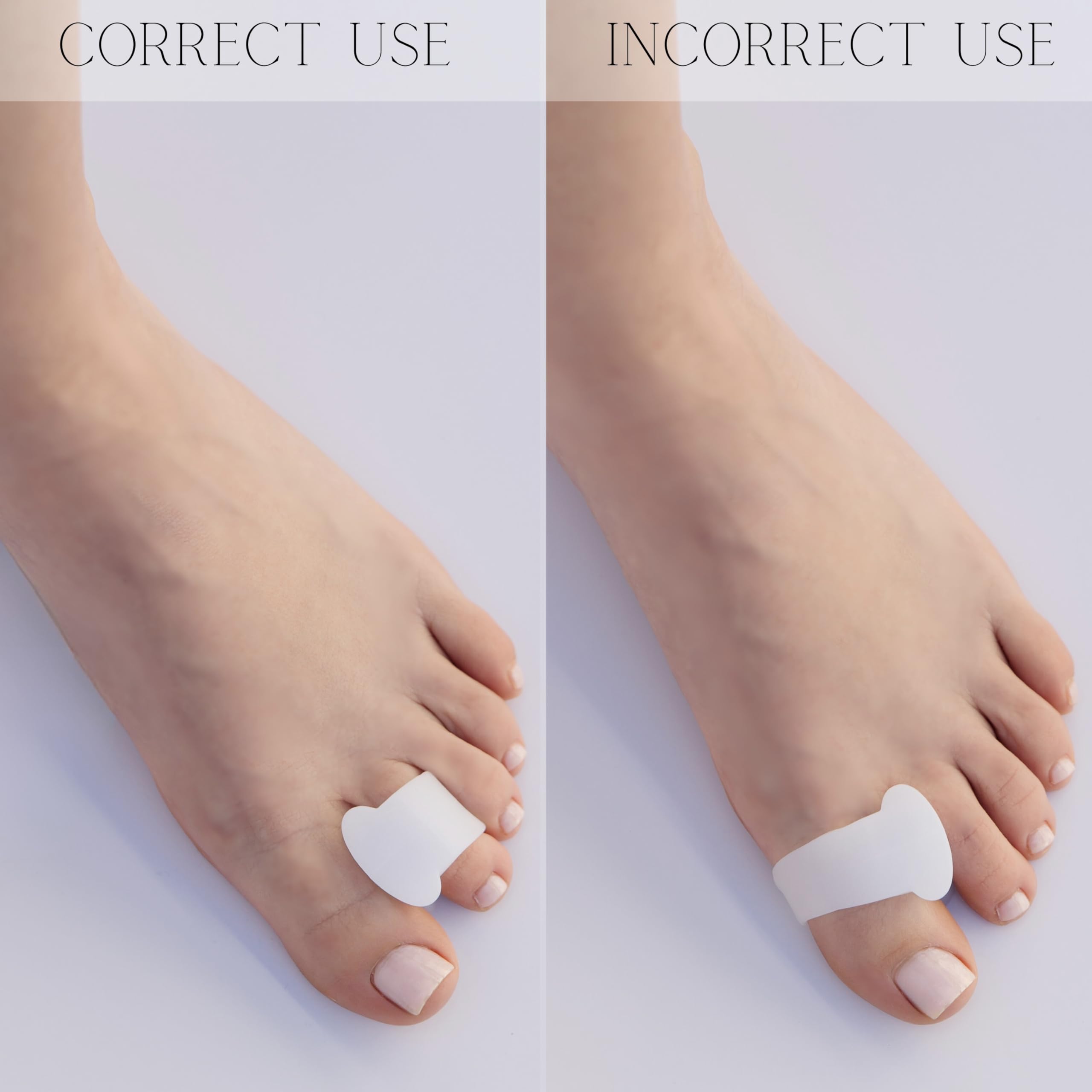 Gel Toe Separators for Overlapping Toes, Bunions, Big Toe Alignment, Corrector & Spacer - 4 Pack (White) - Ideal for Daily Comfort, Post-Surgery Recovery, and Yoga Practice
