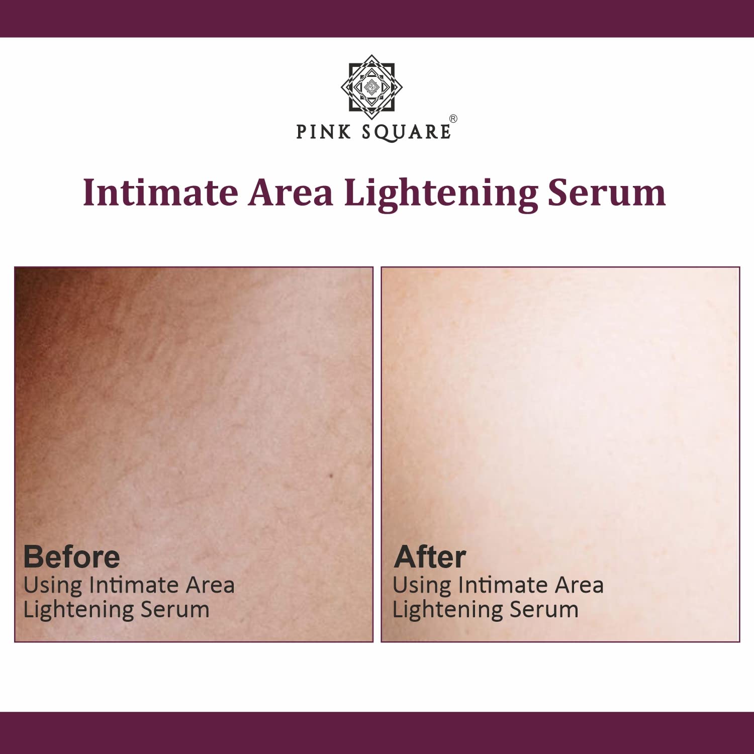 Pink Square Intimate Lightening Serum for Underarms, Inner Thighs, Knees & Bikini Area - 30ml Skin Brightening Cream for Women - Dark Spot Corrector for Sensitive Areas - Perfect for Daily Use & Post-Waxing Care