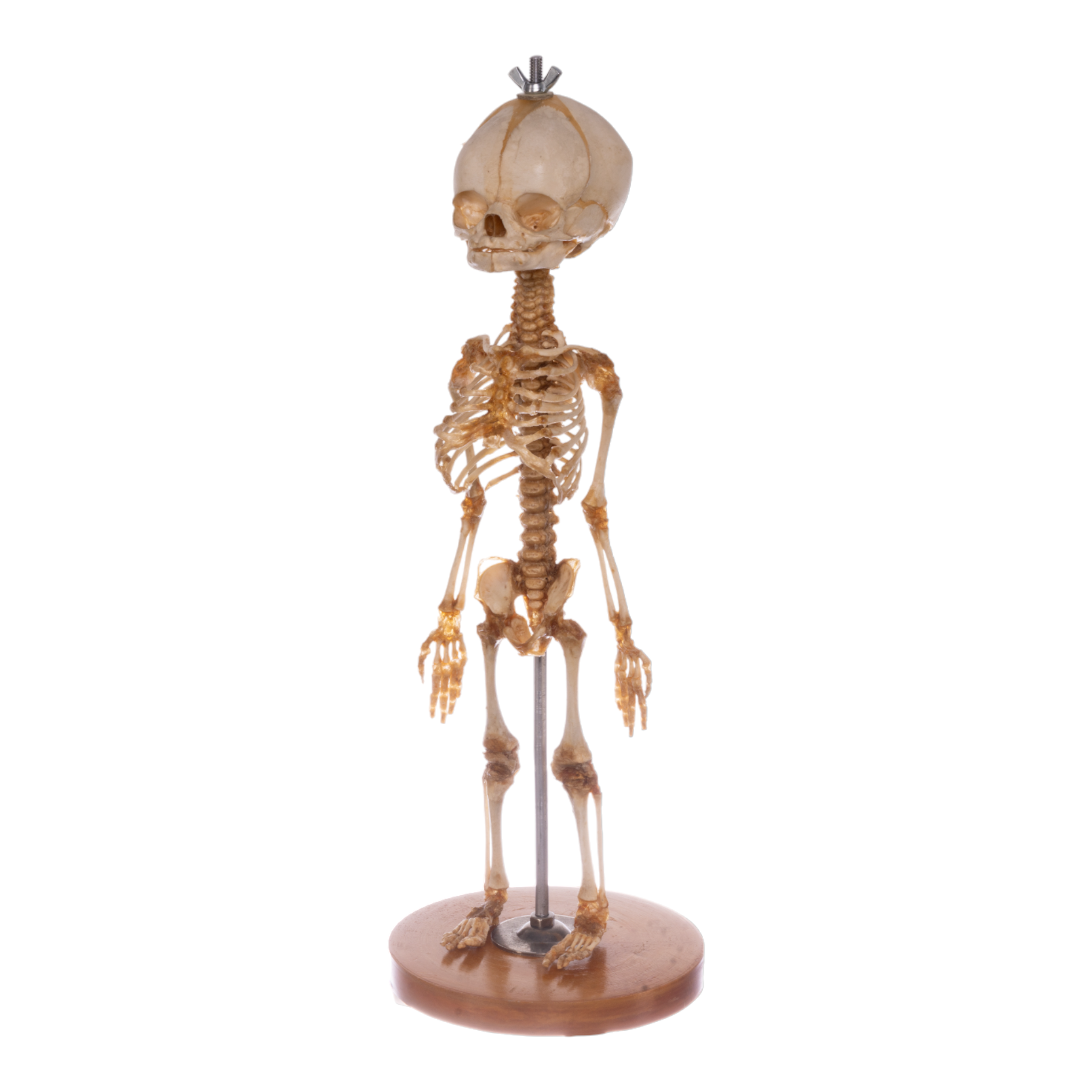 Premium Anatomical Human Fetal Skeleton Model - Medical Research & Education - Perfect for Medical Students, Doctors & Science Classrooms