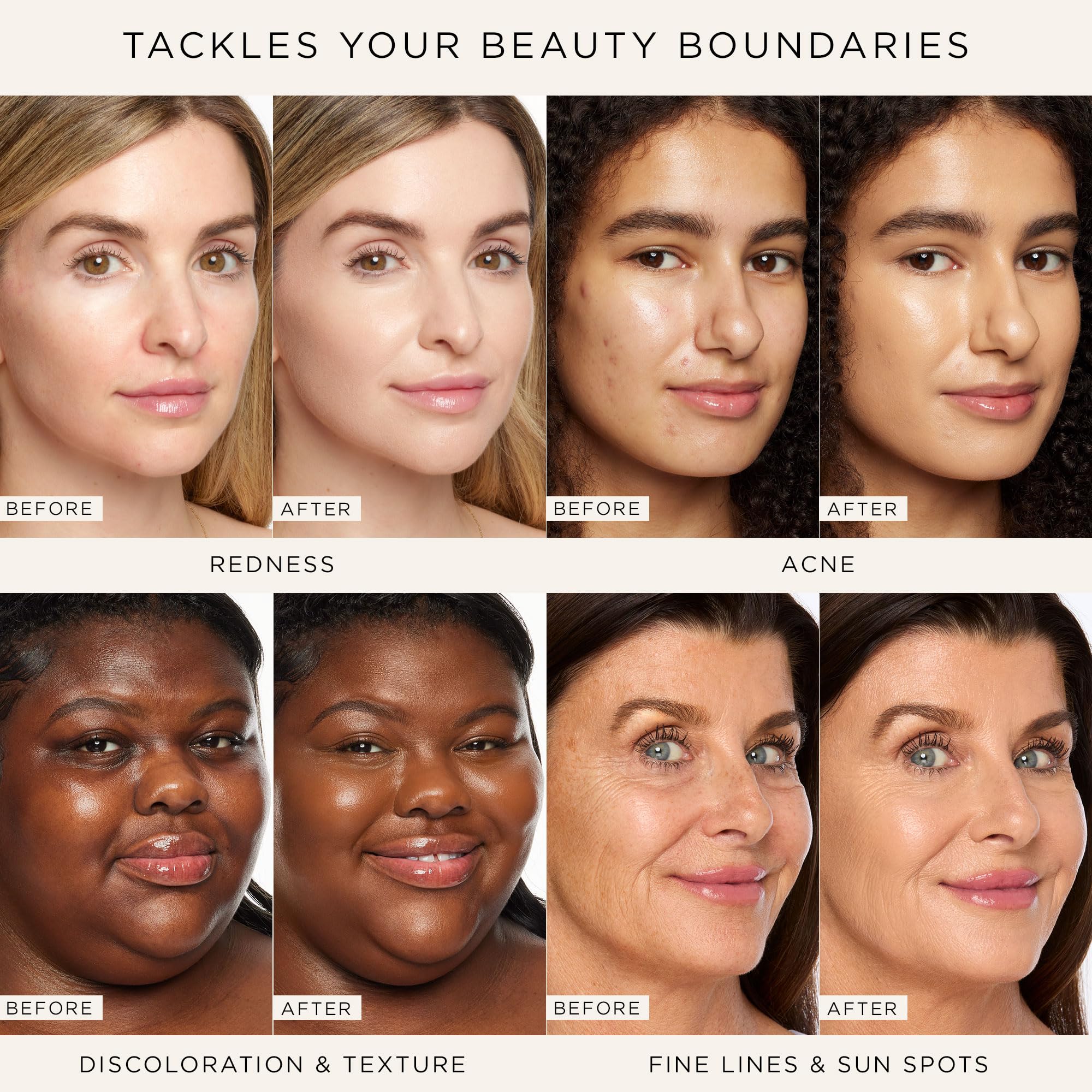 Tarte Shape Tape Radiant Medium Coverage Concealer - 35N Medium (Neutral Undertone) | Flawless Under Eye Brightening & Blemish Covering for Day & Night Makeup