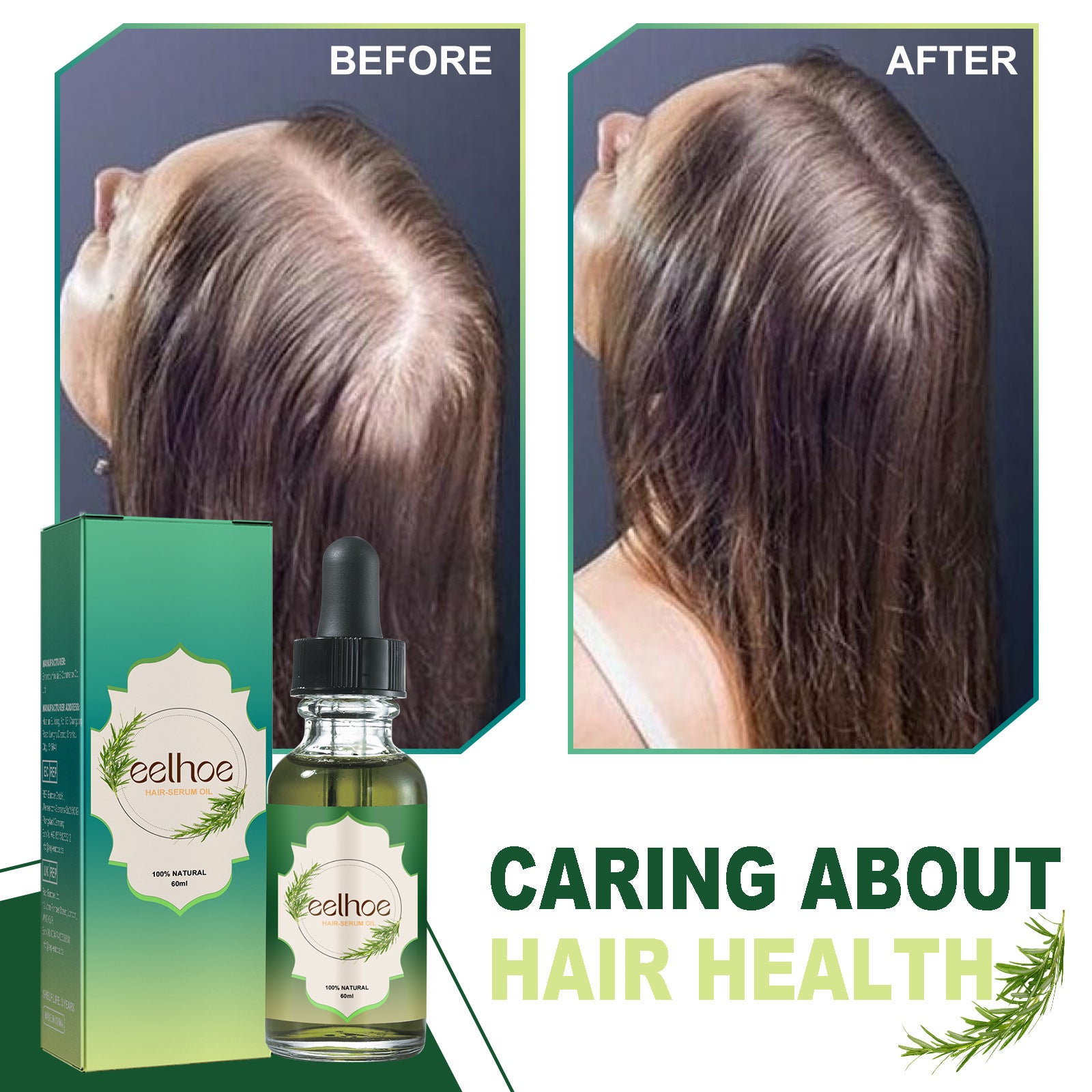 Nourishing Anti-Hair Loss Shampoo for Thicker Hair - Promotes Hair Growth & Reduces Breakage - Perfect for Daily Hair Care Routine