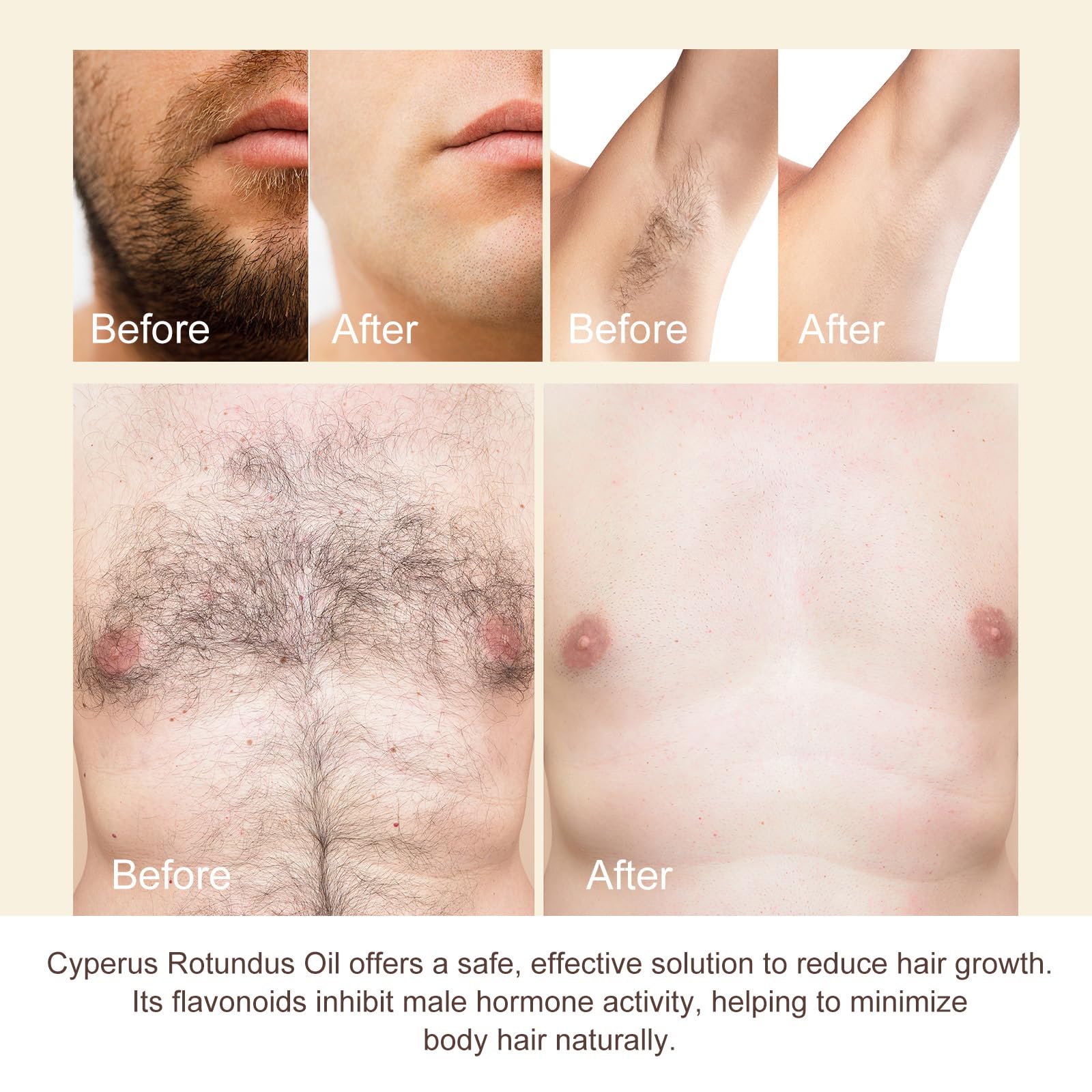 **Pure Natural Cyperus Rotundus Oil for Hair Removal - Reduces Body Hair Growth, Moisturizes & Soothes Skin - Ideal for DIY Waxing, Post-Shaving Care & Sensitive Skin**