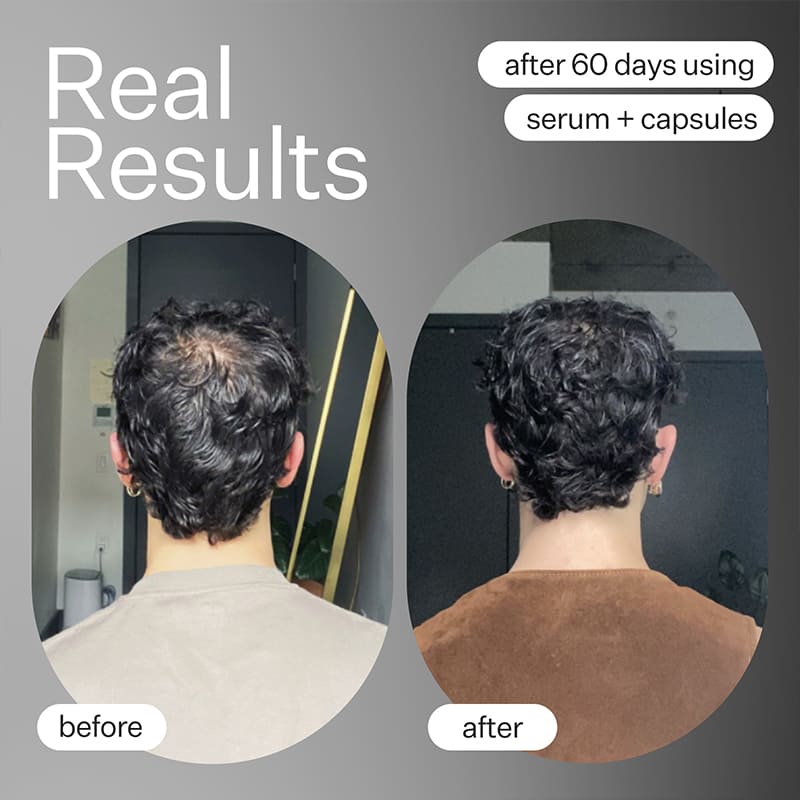 Act+Acre Cold Processed Stem Cell Serum for Hair Growth & Scalp Health - Vegan Hair Treatment for Thicker, Stronger Hair - Perfect for Daily Use & Damaged Hair Repair