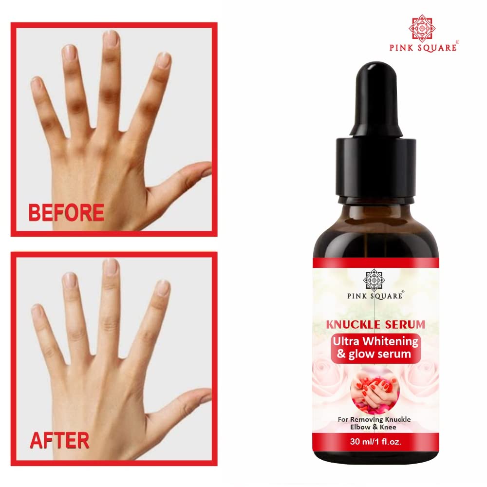 Pink Square Skin Brightening Serum for Dark Knuckles, Hands, Legs, Knees & Elbows - 30ml (1 Pack) | Lightens & Smooths Skin | Perfect for Daily Skincare Routine & Nighttime Use