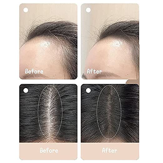 SIMS Natural Hairline Powder - Hair Shading Sponge Pen & Shadow Powder Stick for Quick Root Touch-Up - Includes 3 Stencils (Black) - Perfect for Covering Gray Hair, Thinning Hairlines & Bald Spots - Great for Daily Use, Special Occasions & Hair Styling