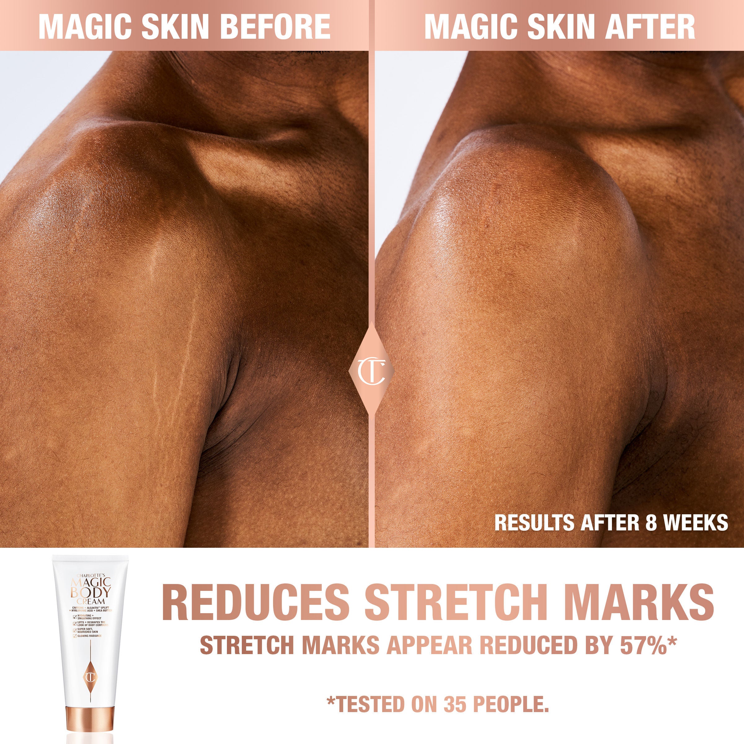 Charlotte's Magic Body Cream - Hydrating & Firming Moisturizer for Dry Skin | Anti-Aging & Stretch Mark Reduction | Perfect for Daily Skincare & Post-Pregnancy Care