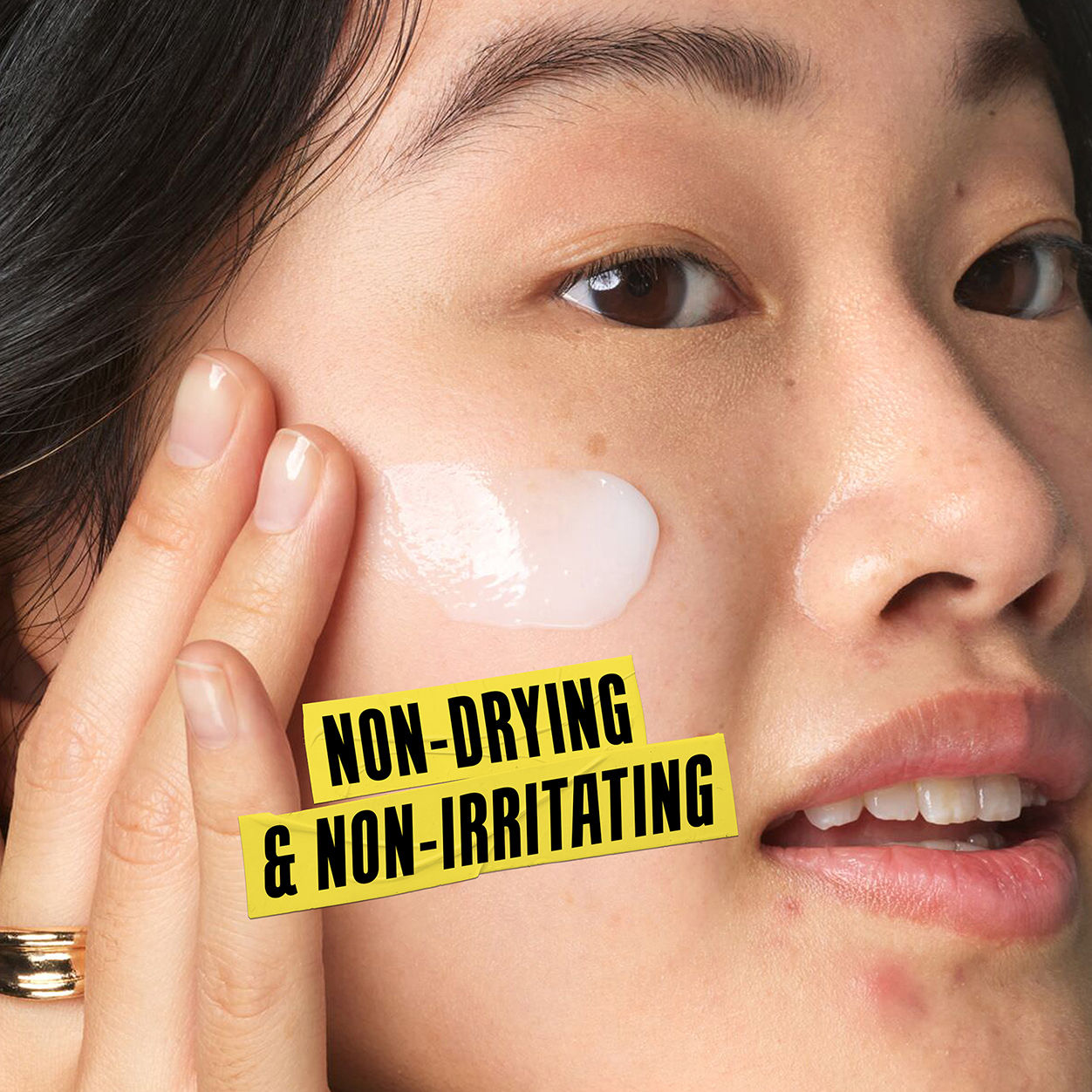 Best Acne Treatment Lotion for Clear Skin - Expert Formula to Prevent & Treat Breakouts | Perfect for Daily Skincare Routine & Oily Skin Care