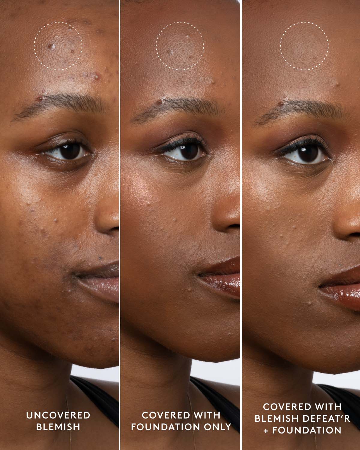 Seal N Conceal Spot Coverage Duo - Full Coverage Concealer & Primer for Acne, Blemishes & Dark Circles - Perfect for Everyday Makeup & Flawless Skin