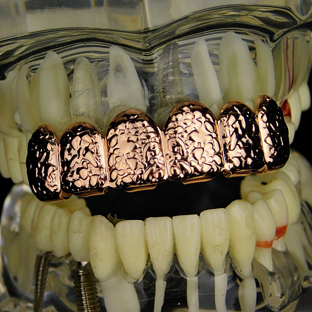 14K Rose Gold Plated Hip Hop Grillz - 6 Piece Upper Teeth Slugs for Men & Women | Perfect for Rappers, Performers & Hip Hop Fashion Enthusiasts