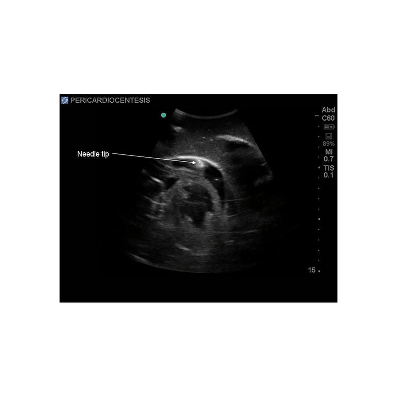 FAST Exam Ultrasound Training Model - Transthoracic & Transesophageal Echo Simulator for Cardiac Sonography Practice (Ideal for Medical Students, Ultrasound Tech Training & Clinical Skills Development)
