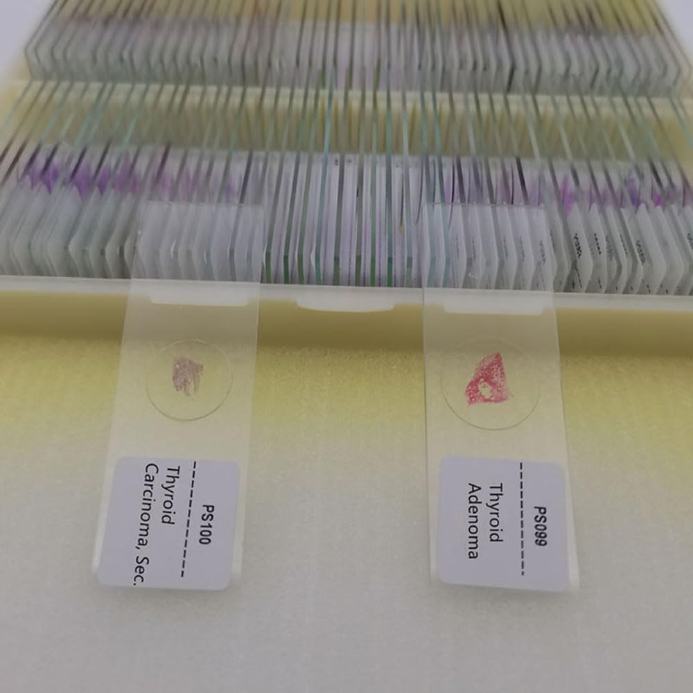 100pcs Human Pathological Tissue Specimen Slides - Prepared Microscope Slides for Medical Education & Research | Ideal for Lab Studies, Histology Classes & Disease Diagnosis