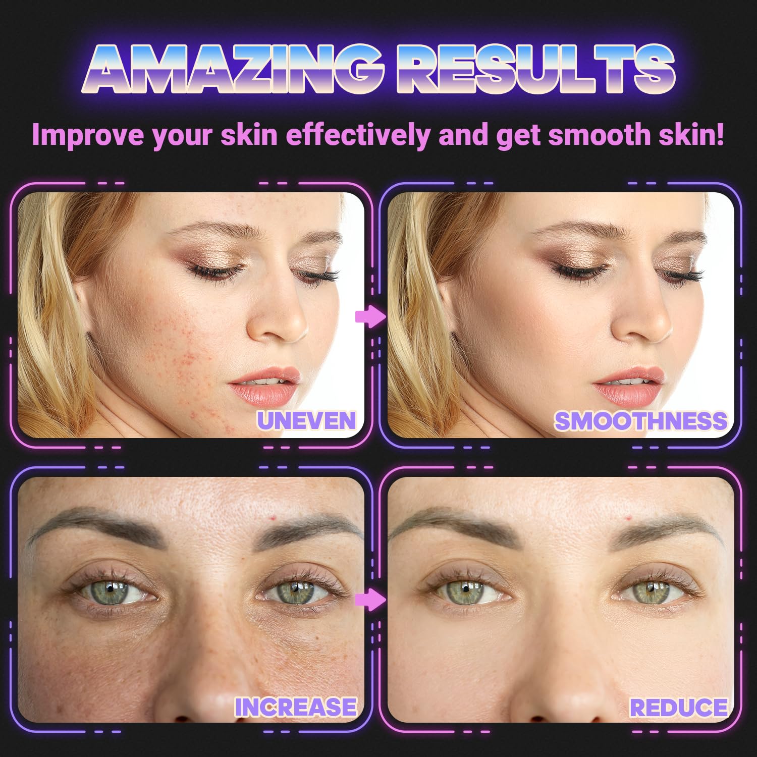 UUPAS High Frequency Light Therapy Wand for Face - Anti-Aging Facial Machine for Acne, Wrinkles & Skin Rejuvenation - At-Home Skincare Device for Spa-Like Treatments