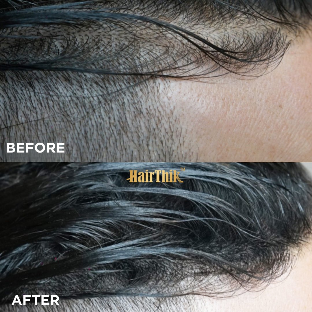HairThik Hair Fibers for Thinning Hair - 25g Concealer for Bald Spots & Receding Hairline - Natural Looking Hair Thickening Powder for Men & Women - Perfect for Daily Use & Special Occasions
