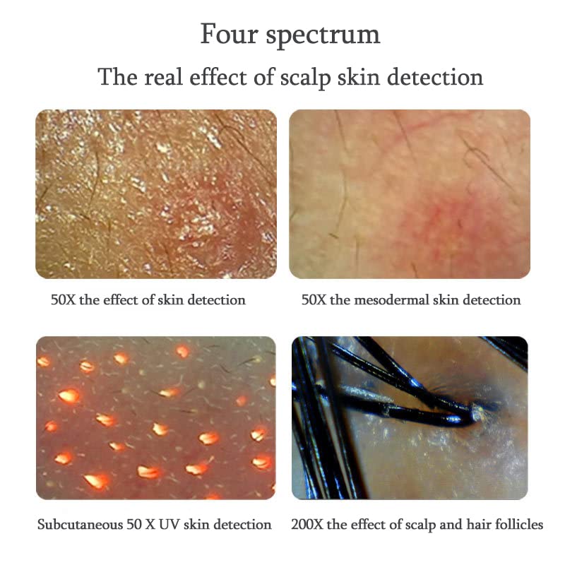 Professional Skin & Hair Detector - 11 Inch Scalp Hair Follicle Analyzer with Moisture & Pores Detection | Skin Pigment Tester | Perfect for Dermatologists, Salons & Home Skin Care