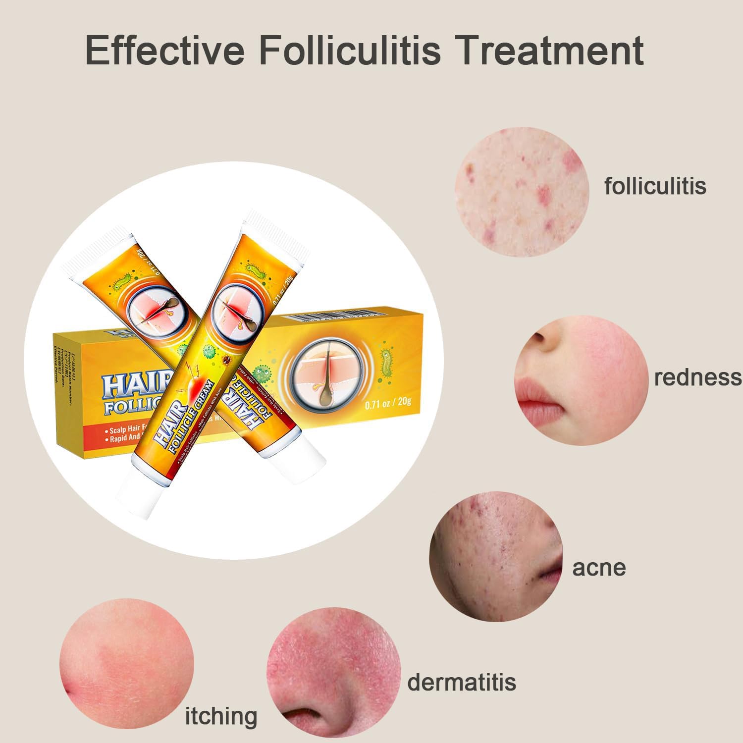 TKTT Folliculitis Treatment Cream - Professional Medicated Cream for Scalp, Body & Face Folliculitis Relief - 20g x 2 Tubes - Soothes Itchy, Inflamed Skin at Home & On-The-Go