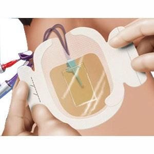 3M Tegaderm 1657 IV Securement Dressing 3.5