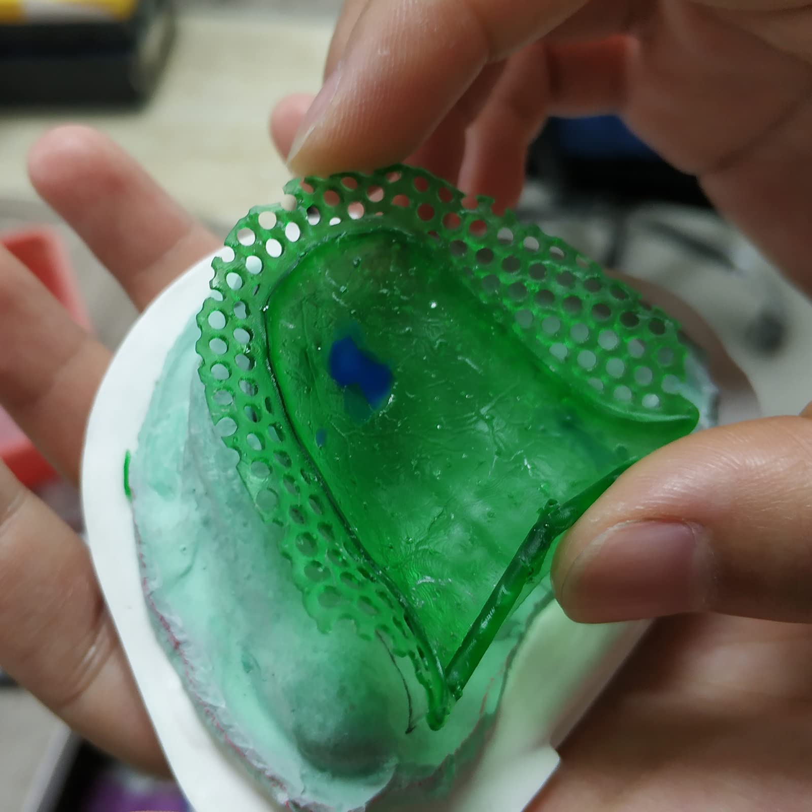 RESIONE C01 High Precision Clear Castable Dental Resin for 3D Printing - Perfect for Crowns, Bridges & Dental Brackets - Ideal for Dental Labs & Orthodontic Applications