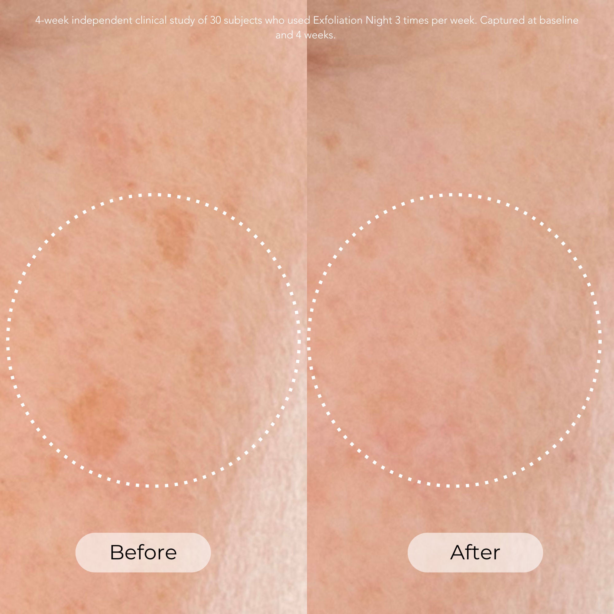 Exfoliating Night Serum for Skin Resurfacing & Brightening - Perfect for Evening Skincare Routine & Glowing Complexion