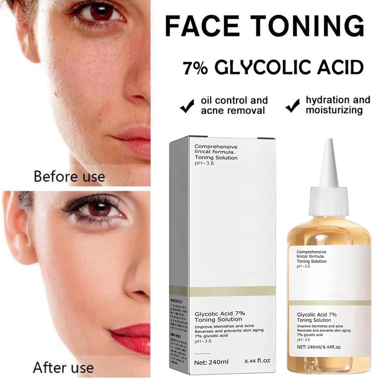 Glycolic Acid 7% Toning Solution - Exfoliating Facial Toner for Smooth & Moisturized Skin - Pore Minimizer & Brightening Serum - 240ml/8.0 Fl Oz - Perfect for Daily Skincare Routine & Acne-Prone Skin Care