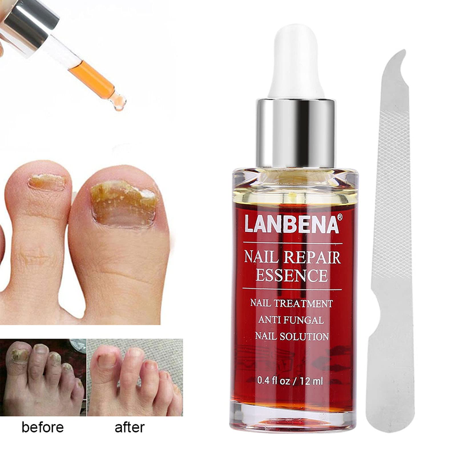 12ML Natural Nail Repair Essence - Powerful Anti-Fungus Treatment for Damaged & Discolored Nails | Effective Nail Care Solution for Toenails & Fingernails | Perfect for Salon Use & Home Manicures